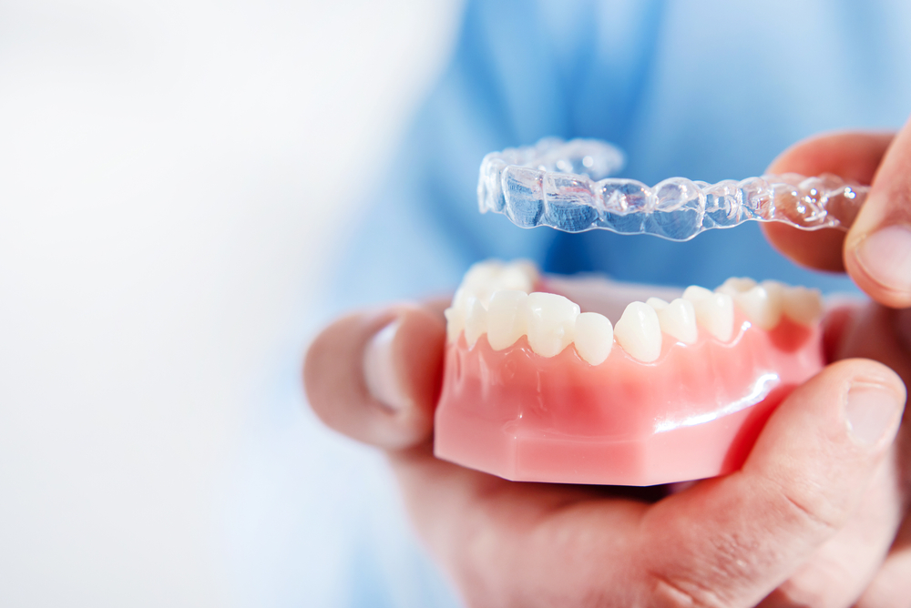 8 Benefits of Invisalign Over Traditional Braces